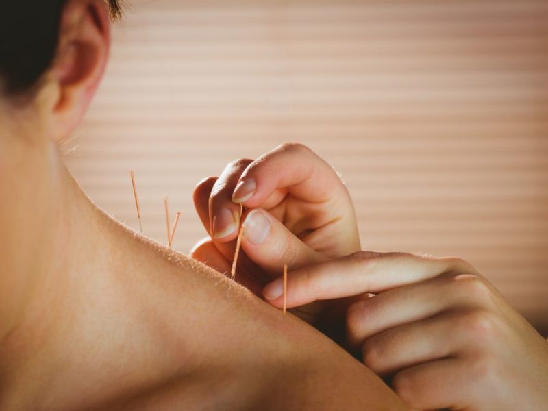 Cinq raisons d’avoir recours à l’acupuncture pour les allergies